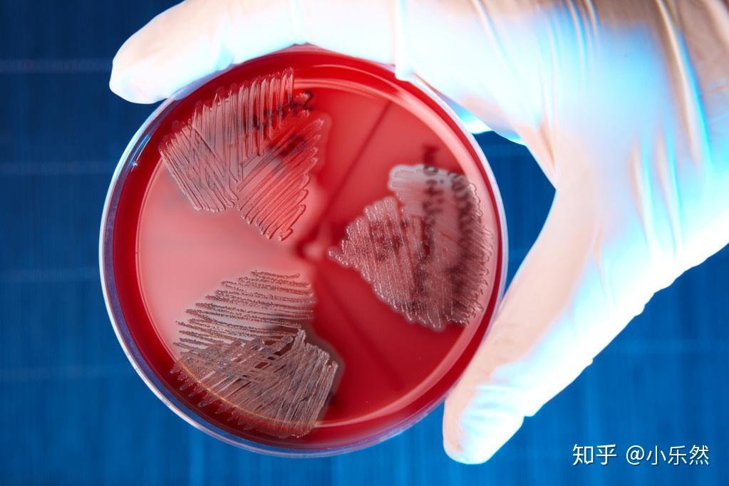 为了赚钱，我找了一份观察微生物的工作！Microbial Sector的六种结局